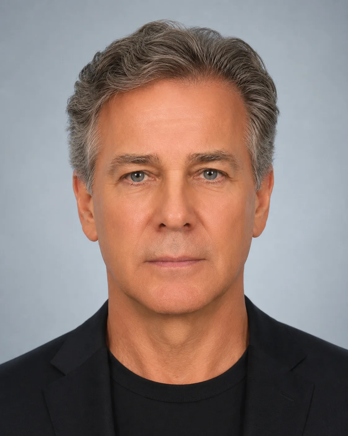 After — real patient facelift result, Case 2 — Male, 64, at Your Cosmetic Surgery & SPA in Miami